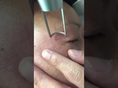 450ps पिकोसेकंड लेजर मशीन 1064nm 532nm Q स्विच्ड एनडी याग