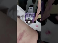 50W फ्रैक्शनल आरएफ माइक्रोनेडल मशीन 100V से 240V तक