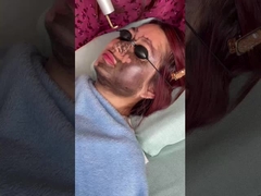 फेस लिफ्ट 585nm 650nm पिकोसेकंड लेजर डिवाइस 500ps 750ps 2000ps